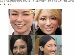 深田恭子　ロレツが回らない理由は度重なる美容整形？