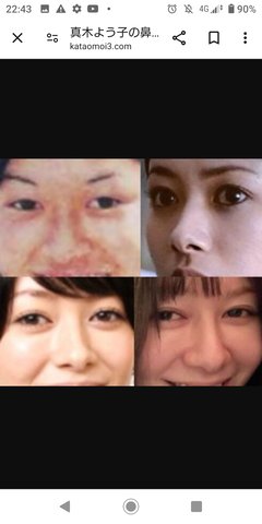 真木よう子　病院のベッドで眠る写真即削除　「こうしたのは岩橋とザコシ」彼女は意識を取り戻さない