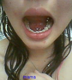 タンリムとタンエッヂピアス入れてる人