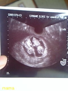 (&#x{11:F9B5};´&#x{11:F9C6};`)友ﾗﾁ①оо人出来るかな&#x{11:F9C0};&#x{11:F9A4};