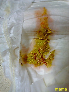 これは救急行くべきでしょうか？