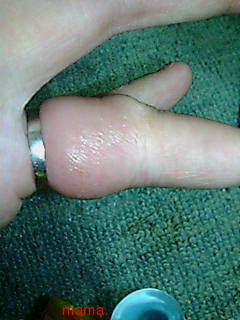 指輪が抜けません