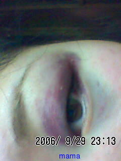 全般からきました。暴力