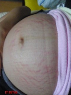 妊娠線見せてください