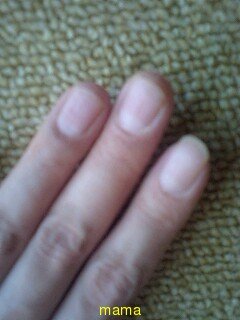 爪が…【写あり】