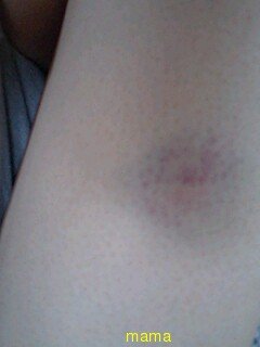 痣見て下さい(写ｱﾘ)