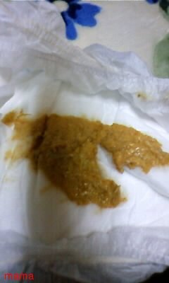 ノロウイルスかな？(汚：うんちの写あり)