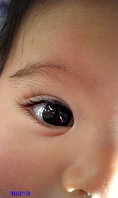 目の下のシワ？くま？(写)