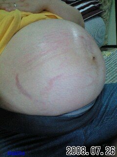 妊娠線見せてもらえませんか