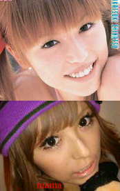 若槻千夏整形？