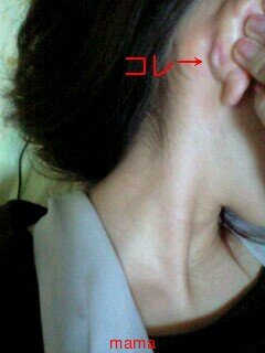 耳の後ろにしこり？写アリ