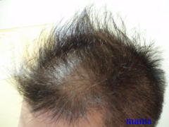 アメトーーク【総合】