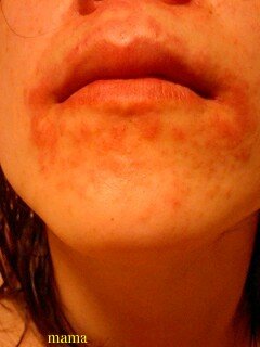 かなりグロ写 この顔どうしたら…