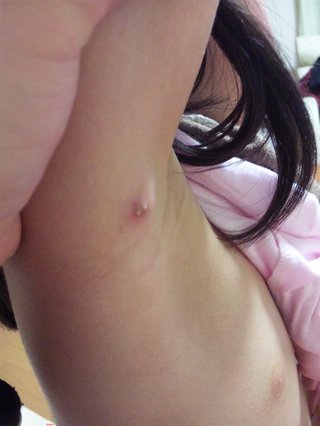 これは小児科？皮膚科？【写あり】