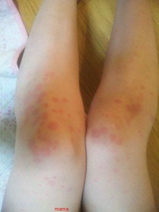 【ちらし裏】聞いてほしいの【ここに書け】