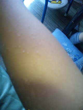 このブツブツ何かわかりますか