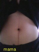 妊娠線。写有り