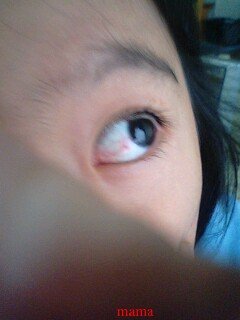 園のお友達から眉毛を切られたらしい