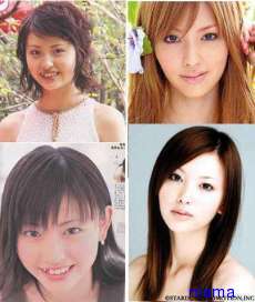 鈴木えみの整形後の顔みたい！