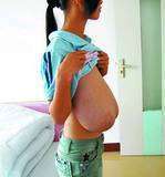 真剣に悩んでます巨乳症(写)