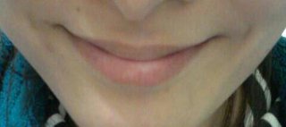 法令線と口角が繋がらへん！