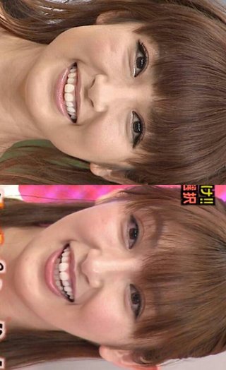 グラビアアイドルの整形前の画像