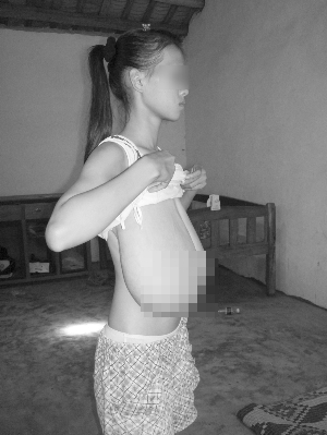 真剣に悩んでます巨乳症(写)