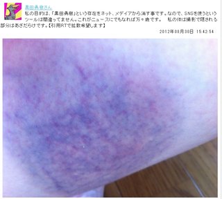 黒田勇樹がDV？         