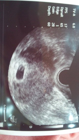 赤ちゃん駄目かも‥