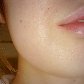 【歯医者怖い】親知不・虫歯【勇気を下さい】