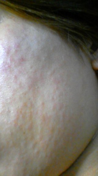 これは風疹ですか？