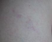 暴力振るわれてますが