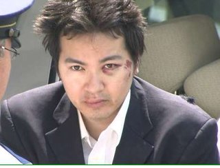 神奈川、女性が路上で切られ重傷「元夫にやられた」