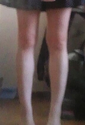 足がぶっとい！アドバイス下さい！