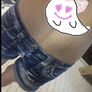 妊娠線とかほんまいらん(T ^ T)