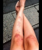 菜々緒､美脚が見るも無残に…【駄】