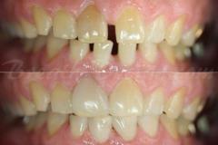 「総合」ミヤネ屋「全国放送」