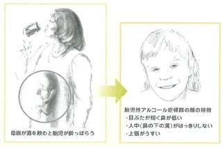 きっと叩かれるであろうことをカキコしてみる