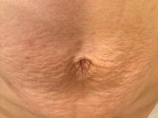 双子を出産しました。【ちょいグロ写】