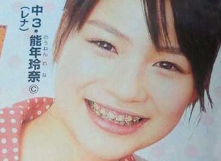 歯列矯正してる（してた）芸能人