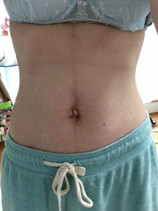 158cm50kgダイエット開始～