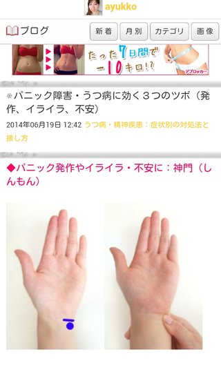 心気症の方(不安神経症、パニックも)話しましょう