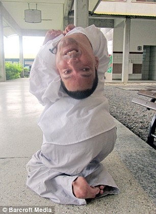 ”逆さまの頭”を持って生まれた男性　ブラジル 