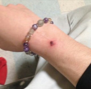 ２５歳父がエアガン乱射、２歳長男に無数の傷