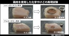 ボタン電池誤飲で消化管に化学やけどの恐れ-国民生活センターが注意呼びかけ
