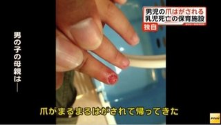 「高熱放置…乳児死亡は保育施設の対応が原因」両親が関係者を告訴…宇都宮