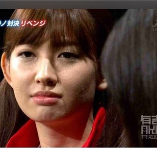 こじはるってめっちゃ肌汚くない？