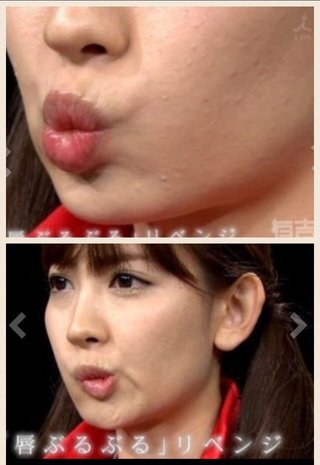 こじはるってめっちゃ肌汚くない？