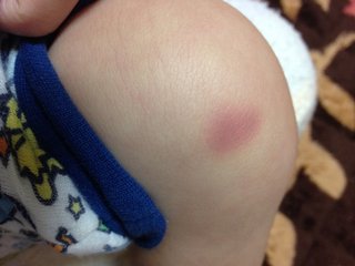 小児白血病でしょうか。詳しい方