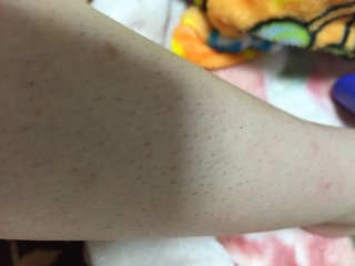 私より剛毛いる？